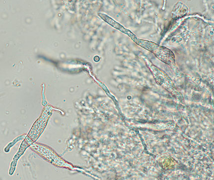 Gloeocystidiellum porosum